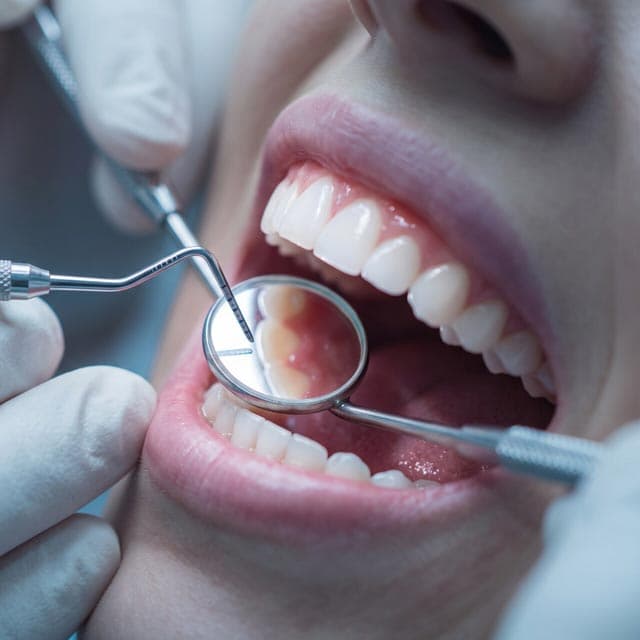 Tratamientos de periodoncia en Foz - Clínica Rosón